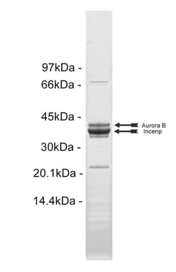 Eurofins DiscoverX Aurora B Protein, Active 10 &mu;g | Buy Online | Eurofins DiscoverX | Fisher Scientific